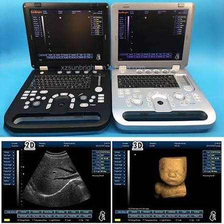 ECHOGRAPHE PORTABLE 4D IDEAL POUR LES HOPITAUX ET CENTRES DE SANTE